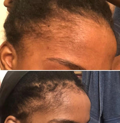 Hyper Hair Regrowth Serum  1 Month (4 Treatments)