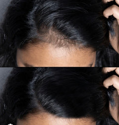 Hyper Hair Regrowth Serum  1 Month (4 Treatments)